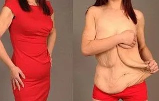 成都穴位按摩可以减肥吗？