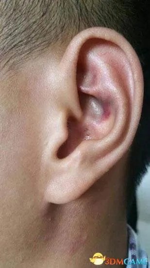 高三班长遭老师毒打 疑因未能组织同学集体送礼