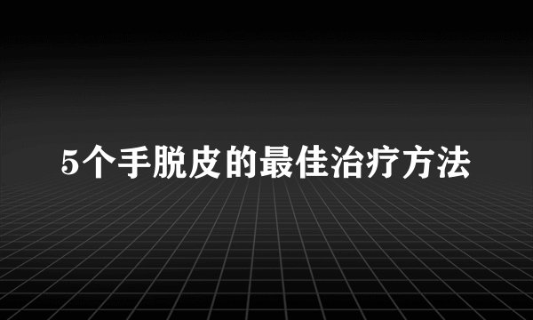 5个手脱皮的最佳治疗方法
