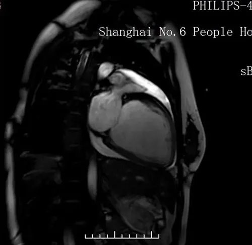 沈虹:用“心”护“心”,不唯“心”论