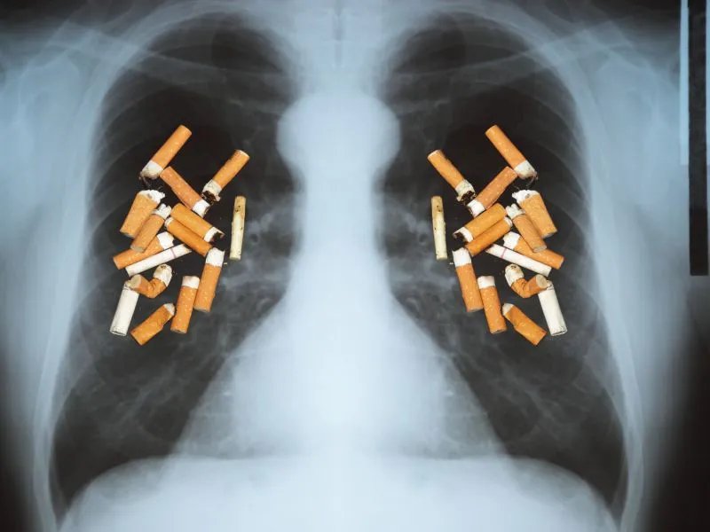 肺癌的生物免疫治疗