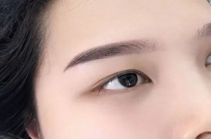 切眉手术要注意什么