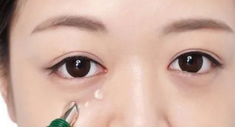 全切做的好的苏州医院有哪些