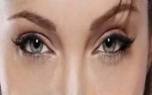 眼睛整容多少钱