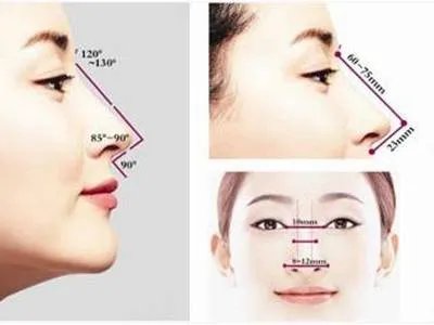 假体隆鼻手术过程是什么？