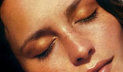 老年斑图片对比