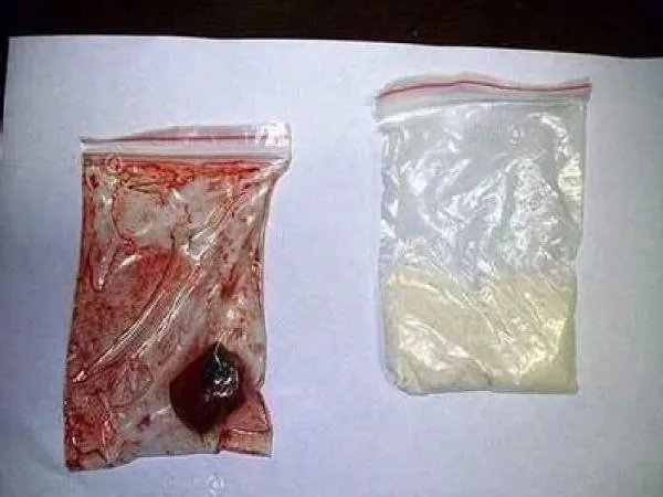 广东碰瓷团用黄鳝血充人血专人演交警是真的吗？