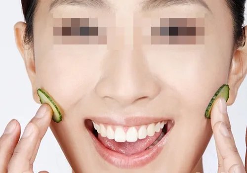 丰脸颊需要多少钱呢