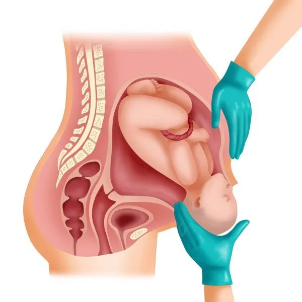 计生办强制引产合法吗