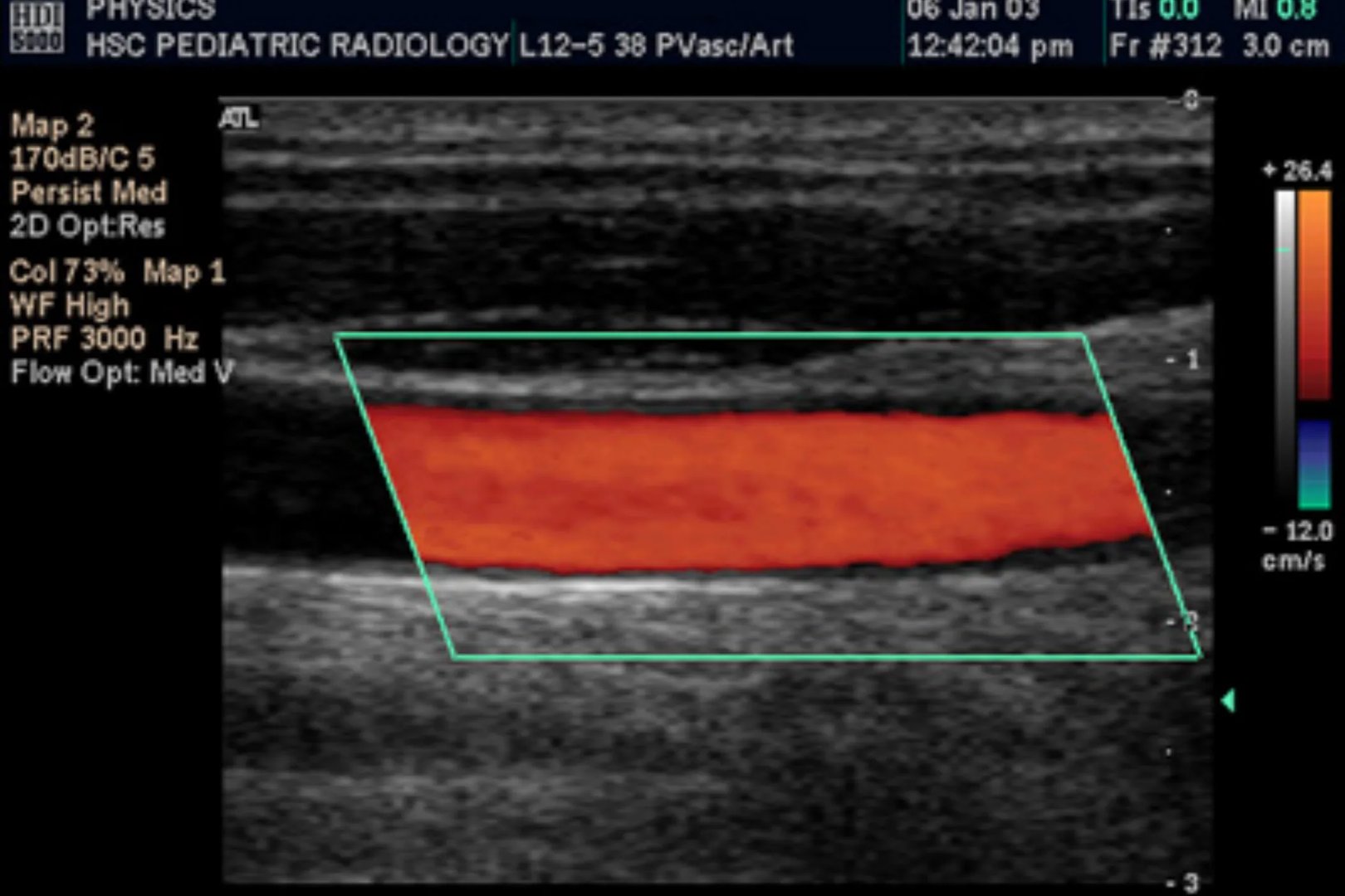 彩超是检查哪些部位的