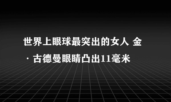 世界上眼球最突出的女人 金·古德曼眼睛凸出11毫米
