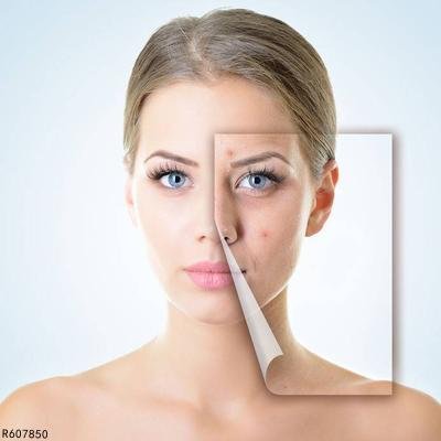 彩光祛痘有效果吗