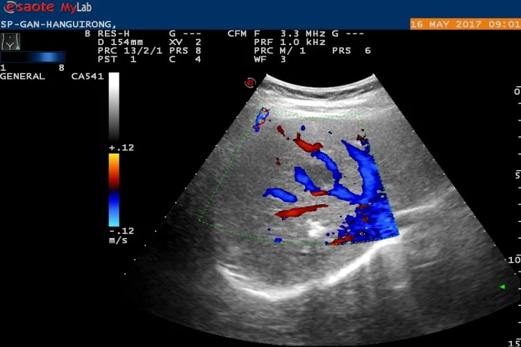 彩超是检查哪些部位的