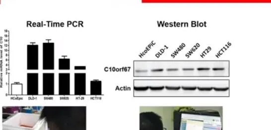 又有2名小学生研究喝茶抗癌获奖怎么回事 2名小学生研究喝茶抗癌获奖什么原因