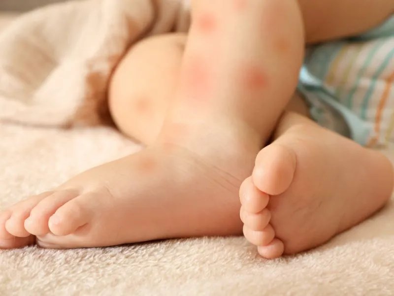 完全水解奶粉是什么