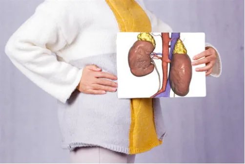 得肾结石怎么办