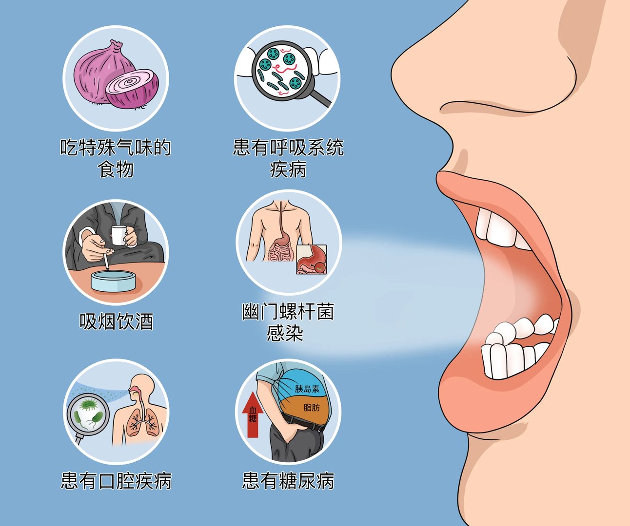 引起口臭的主要原因