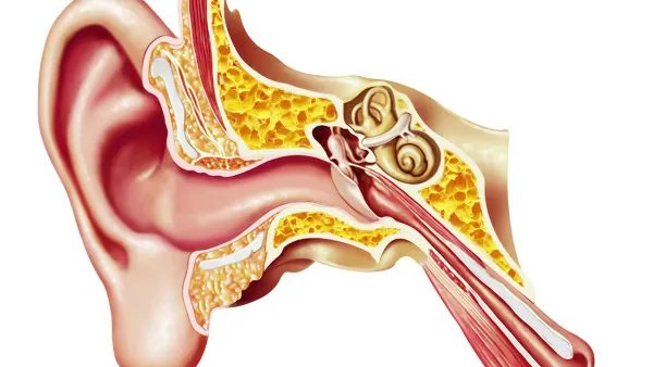 人工耳蜗是什么