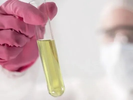 导致生理性蛋白尿的原因