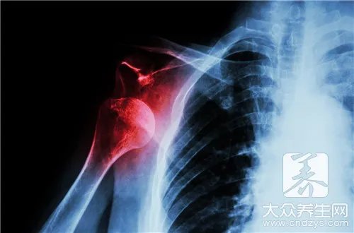  火寒毒是现代的什么病