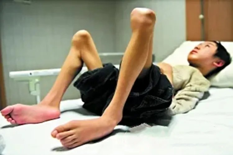 儿童厌食症图片