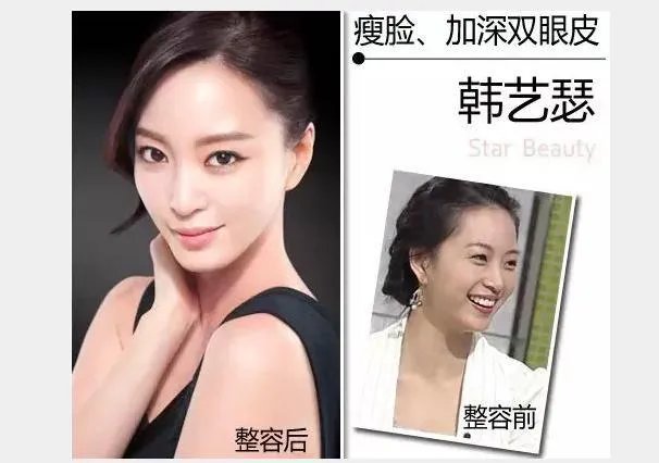 韩艺瑟整容前后对比图变化惊人 韩艺瑟韩国人气如何家里很有钱吗