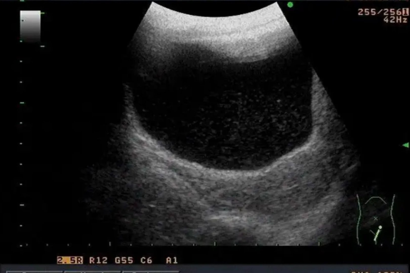 彩超是检查哪些部位的