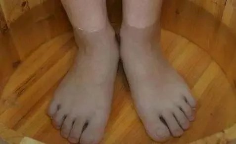 身体出现哪些症状，就说明你该排毒了呢？