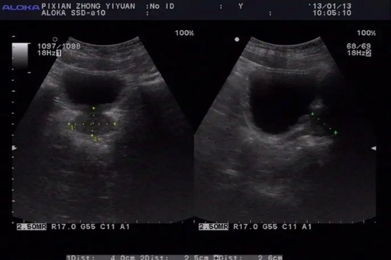 彩超是检查哪些部位的