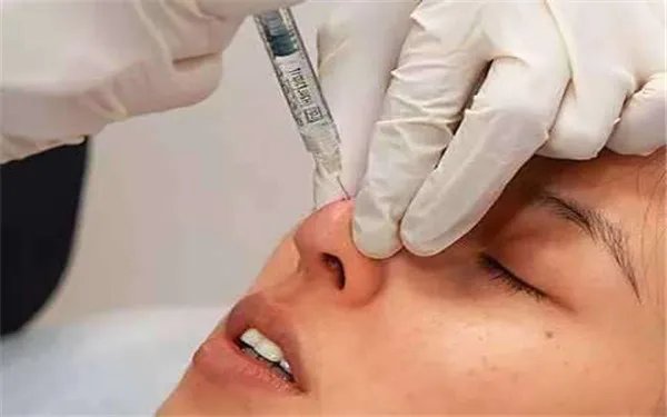 膨体隆鼻和硅胶隆鼻