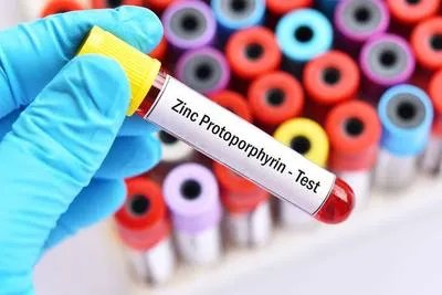 溶血尿毒综合征如何治疗