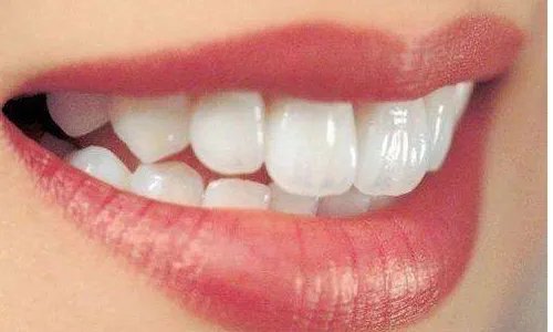 植一颗牙多少钱