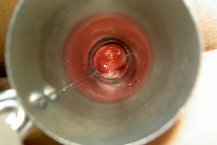 女性痔疮是什么样子的图片