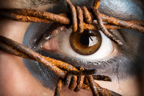 泪道疾病的诊断与治疗