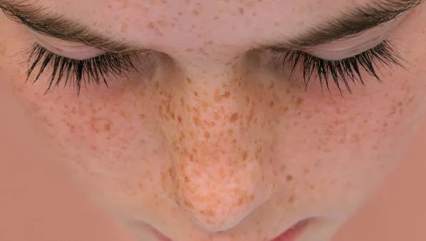 吃什么能淡化色斑