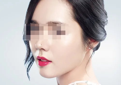 丰脸颊需要多少钱呢