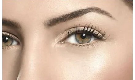 韩式埋线双眼皮的优缺点