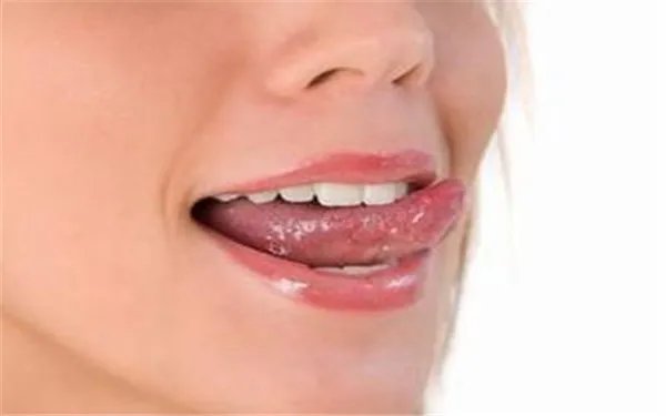 嘴巴上火起泡怎么快速消除
