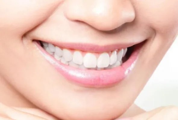 牙齿激光美白价格多少