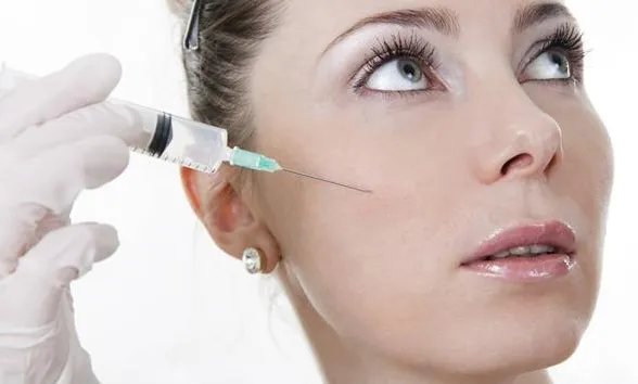 玻尿酸填充法令纹效果