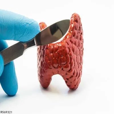 甲状腺肿大的治疗方法有哪些