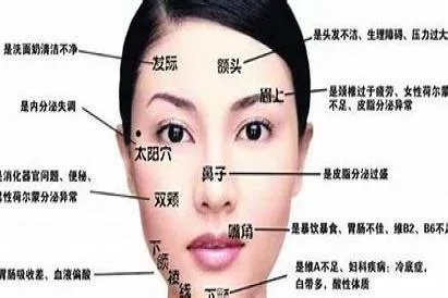 脸上痘痘分布图和对症