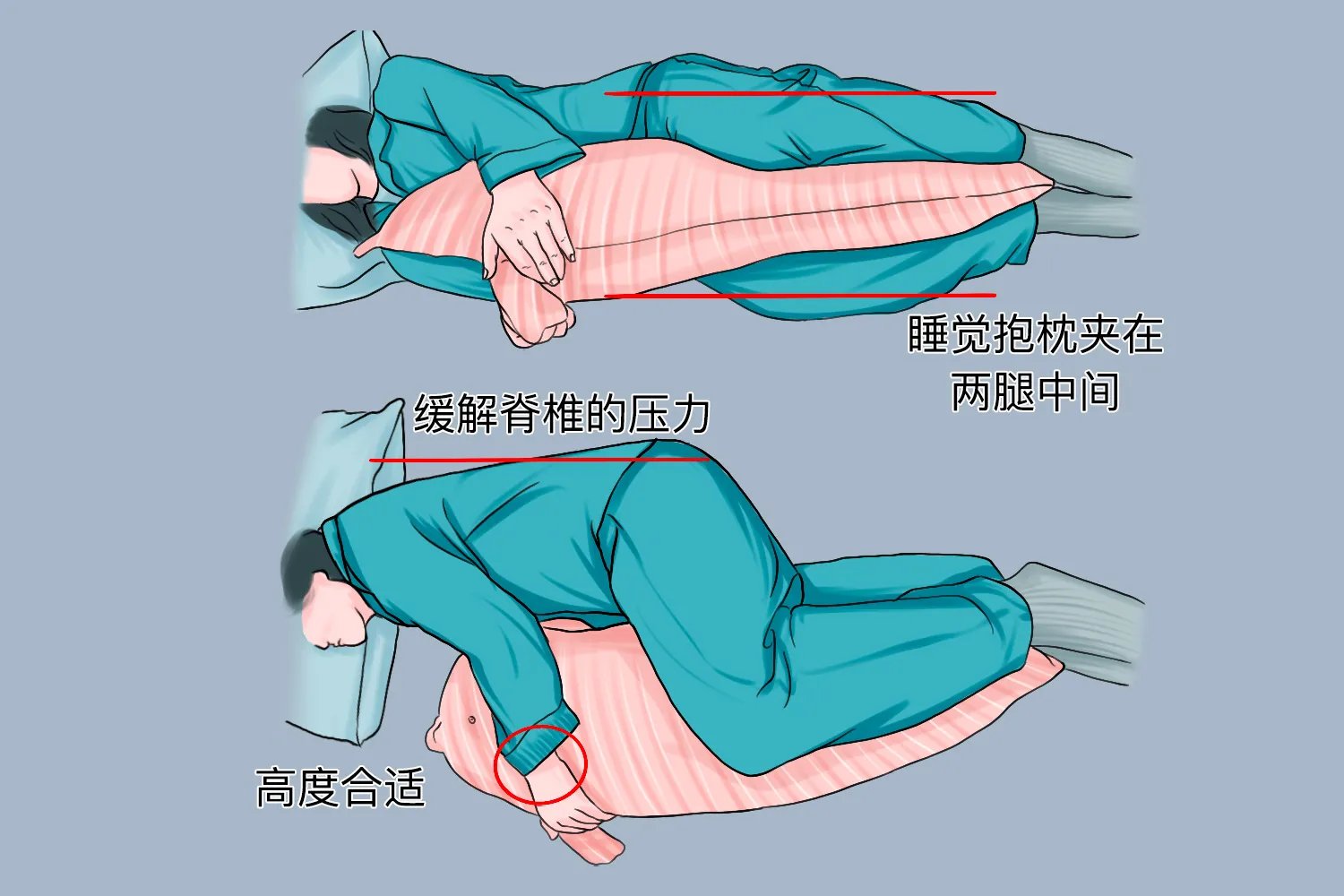 腰间盘突出手术后正确睡姿图