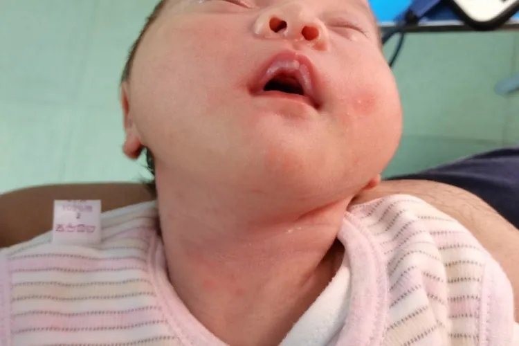 宝宝贫血嘴唇发白图片