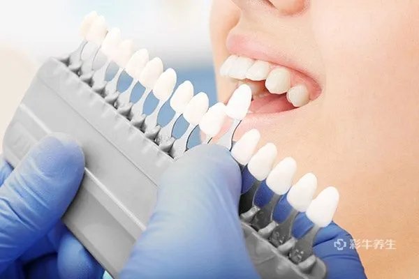 洗牙一次大概多少钱