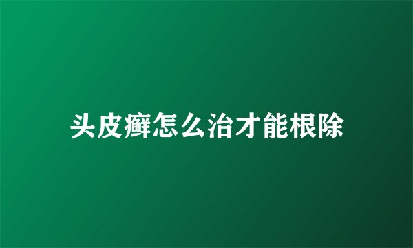 头皮癣怎么治才能根除