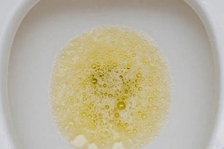 正常尿和泡沫尿图片