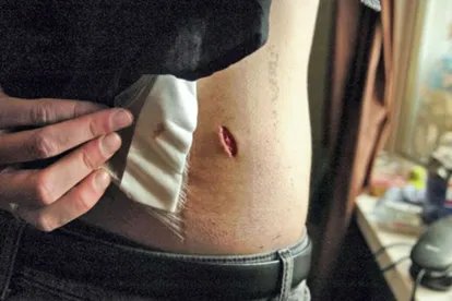 后背疼痛图片示意图及病情对照