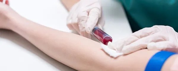 性激素6项检测是什么