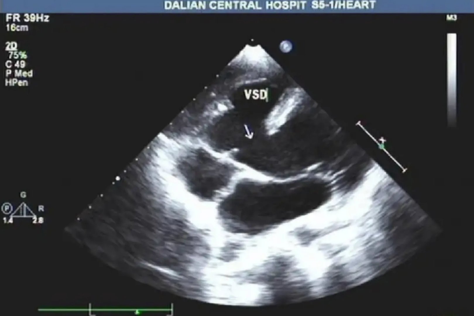 彩超是检查哪些部位的